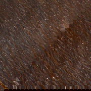 dandruff or head lice